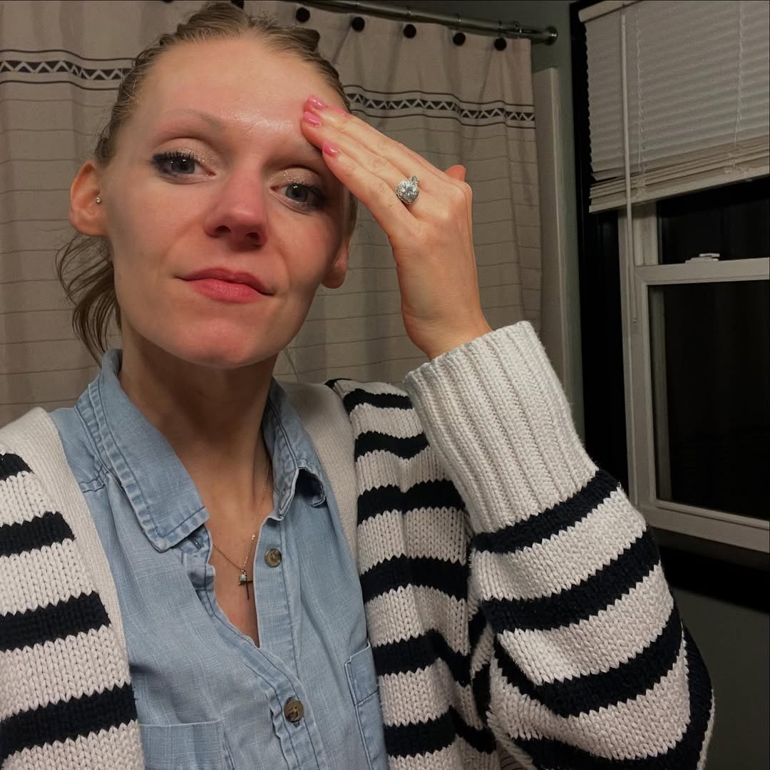 Volufiline vs. Injectable Fillers