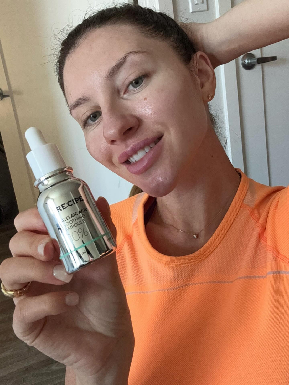 How Azelaic Acid Fades Hyperpigmentation & Acne Marks Over Time